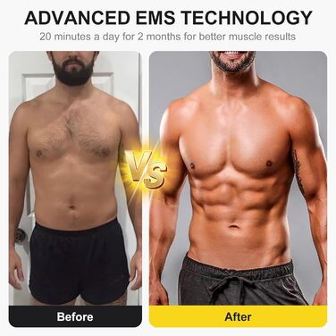 EMS тренажер для пресу Relassy: електричний, з 10 режимів та 30 інтенсивностей, USB, для живота, рук, ніг