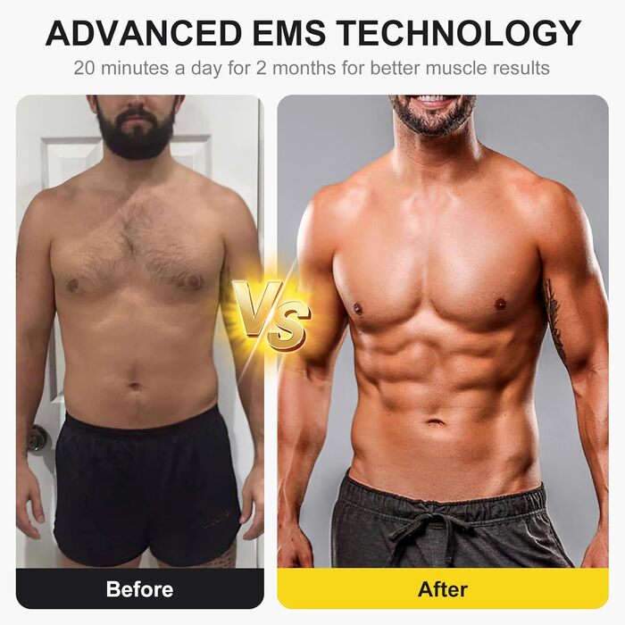 EMS тренажер для пресу Relassy: електричний, з 10 режимів та 30 інтенсивностей, USB, для живота, рук, ніг