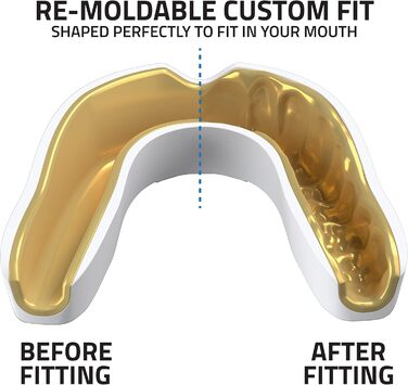 Захисний капу для спорту Titanium Sports Premium - Slim Fit з чохлом. Захист для боксу, MMA, джудо, карате, регбі, хокею, футболу. Підходить для дітей (<11) та дорослих (+12). Золотистий колір.